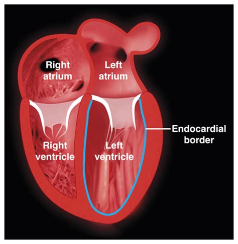 what is lv function|2d lv pw abnormal.